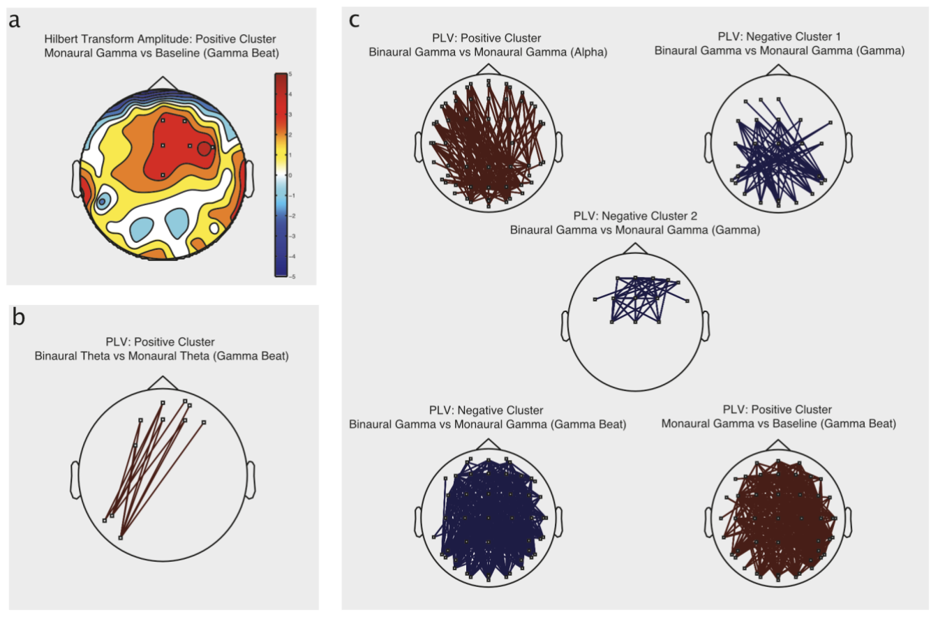 løn foredrag hjul Binaural Beats through the auditory pathway: from brainstem to connectivity  patterns – Guillaume Dumas